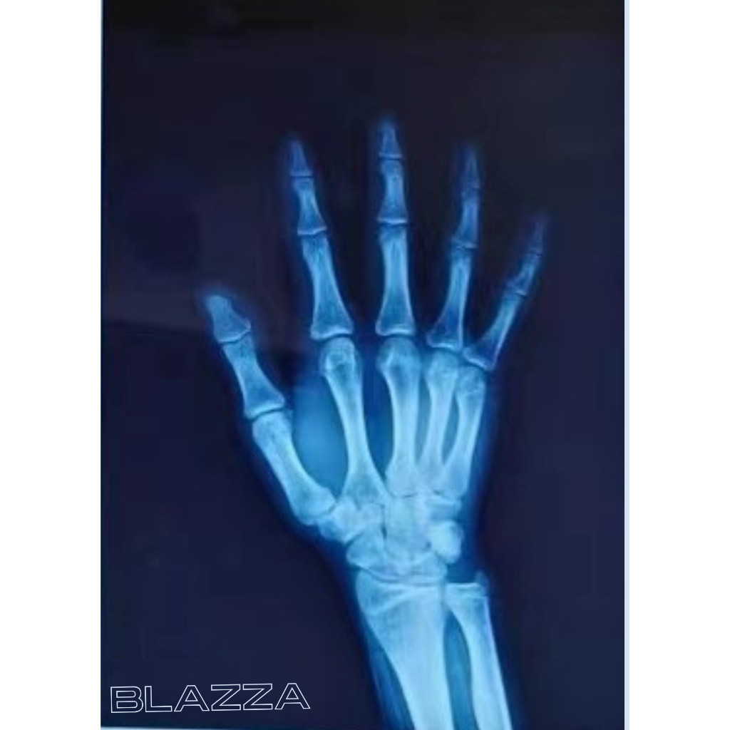 Jual Cetak Film Medical Dry Radiology DR CR Rontgen X-Ray | Bluebase ...