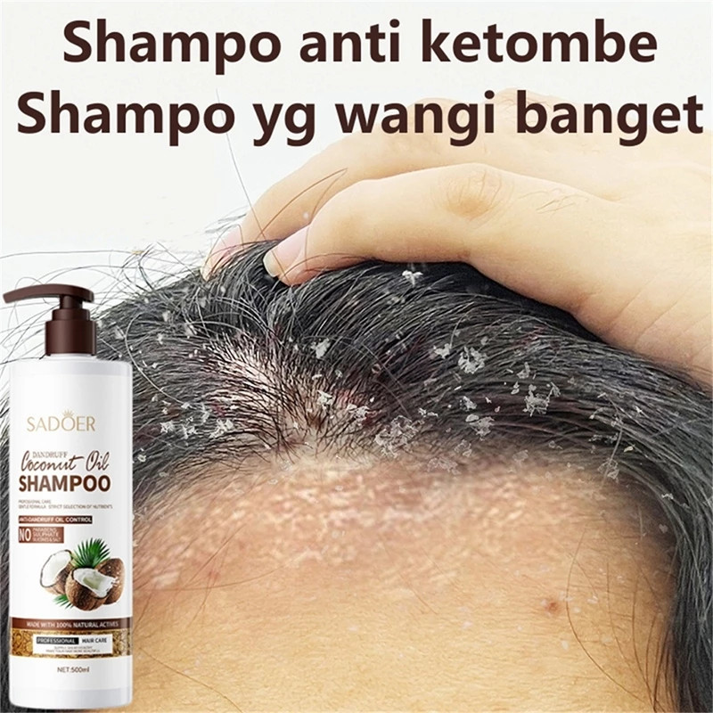 Jual Shampo anti ketombe 500ml shampoo ketombe berkerak shampoo