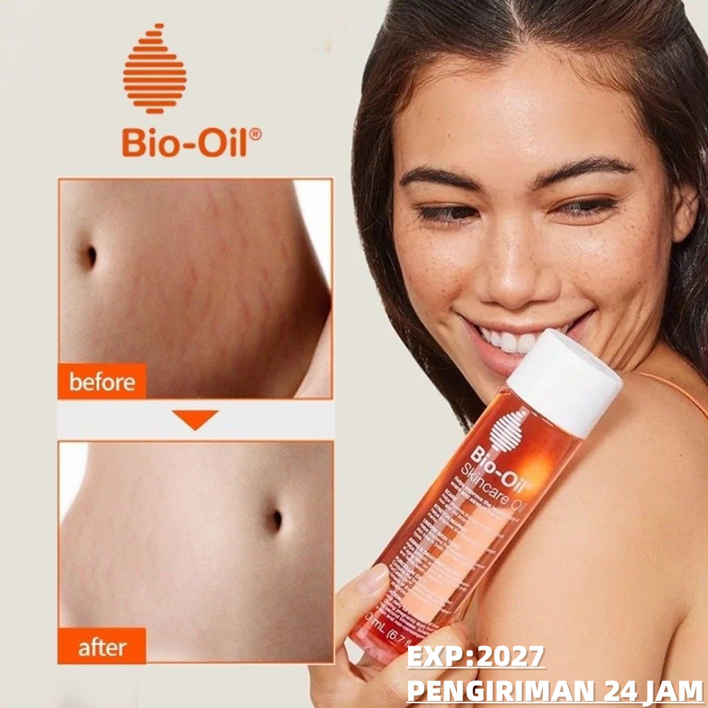 Jual 【COD Beli 2 gratis 1】Bio Oil Skincare 200 ML / Bio Oil Penghilang ...