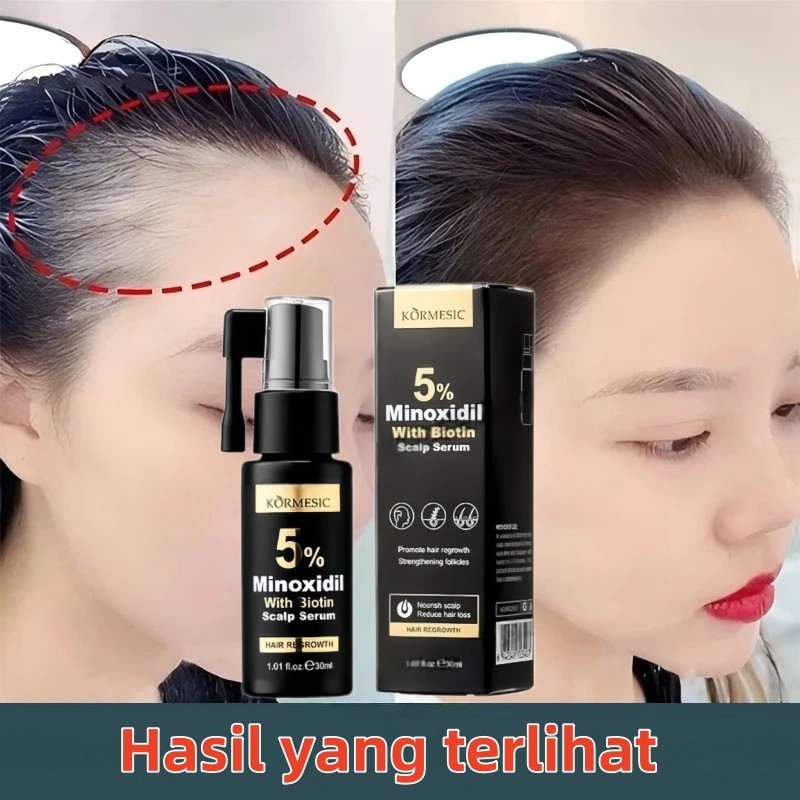 Jual Minoxidil penumbuh rambut serum penumbuh rambut obat rambut rontok ...