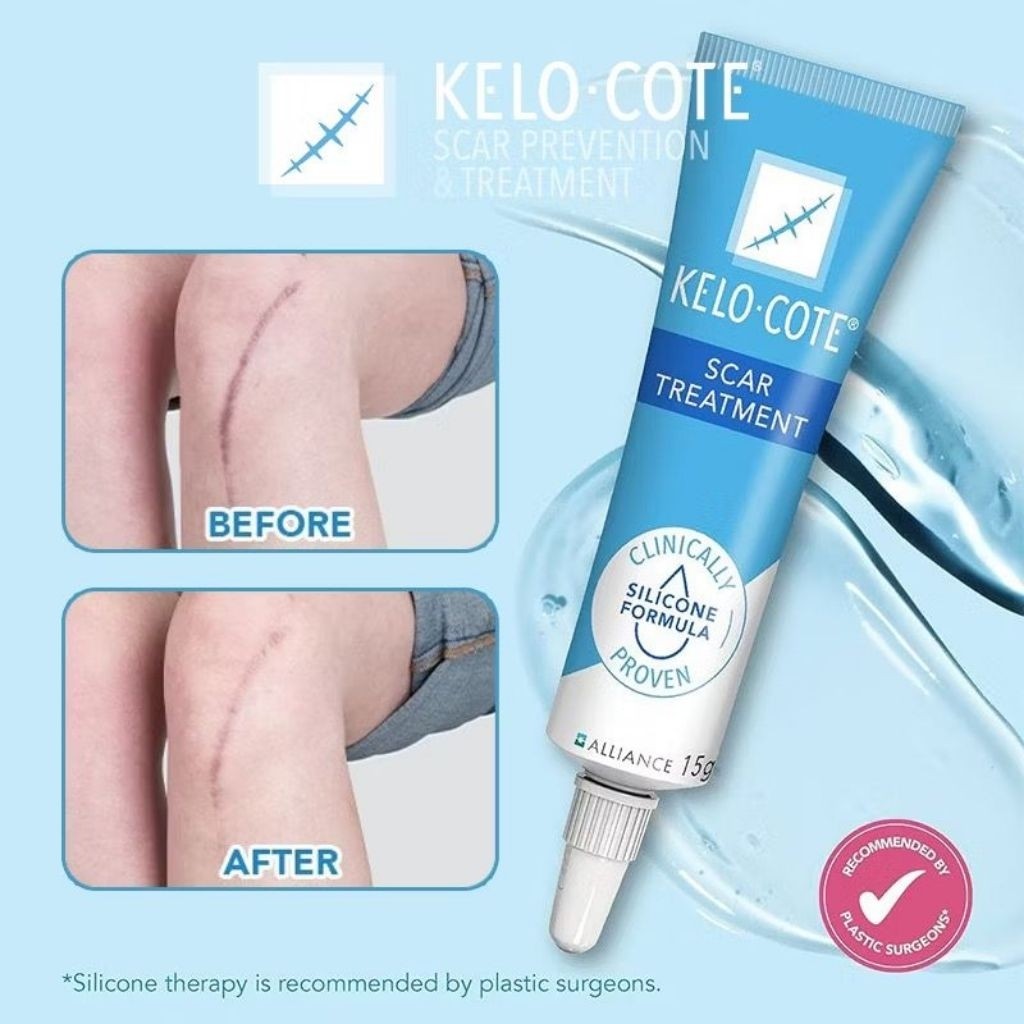 Jual Kelo-Cote SCAR Gel 15gr – Gel Penghilang Bekas Luka & Keloid ...