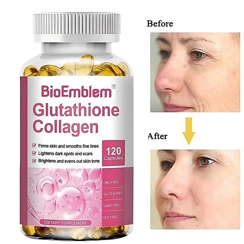 glutathione for endometriosis Frontiers
