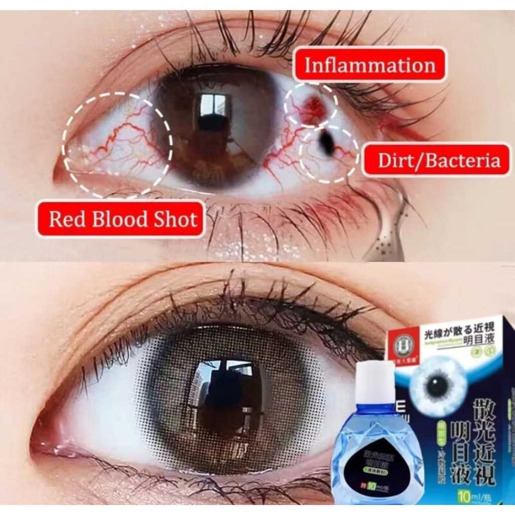 Jual Obat Tetes Mata Obat Mata Katarak Eye Drop Tetes Mata Katarak Obat ...