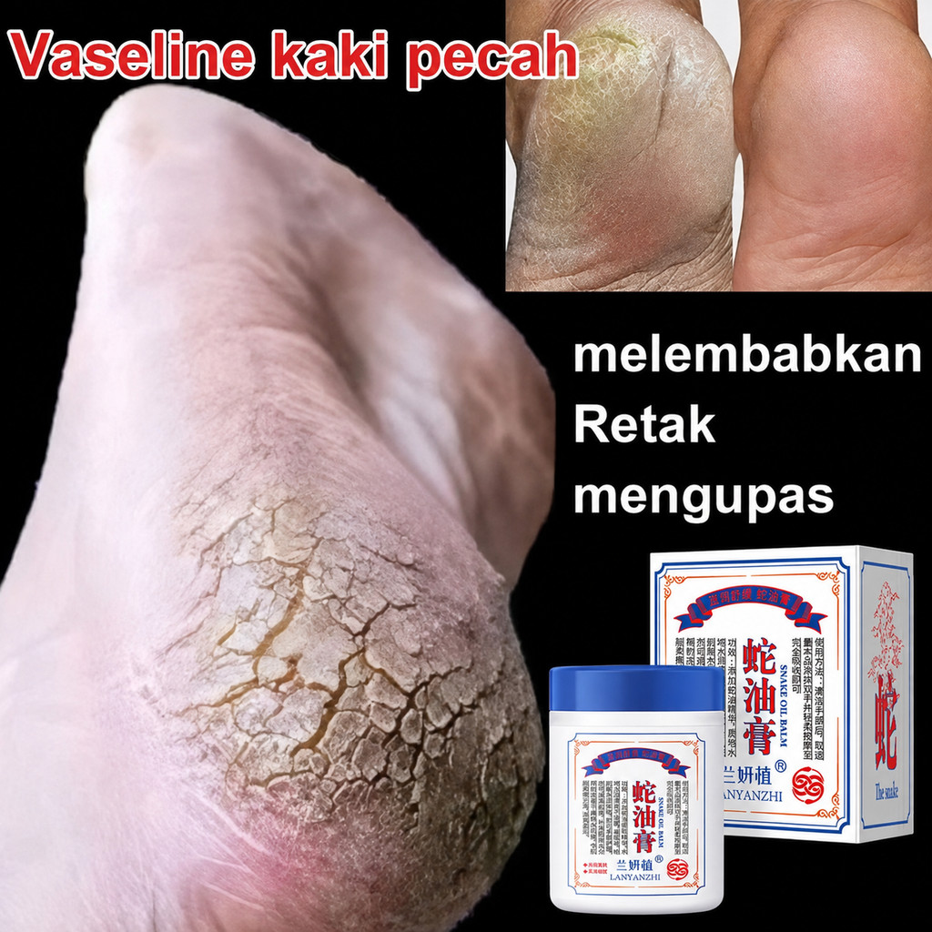 Krim Kaki Pecah Dan Kering Dan Kasar Ampuh 100% Original Foot Cream Callus Remover Foot Hand Cream Ultra Pelembab Obat Tumit Kaki Dan Tangan Kering Cream Tumit Kaki Pecah Dan Kering Salep Penghilang Pecah Pecah Di Kaki 110g