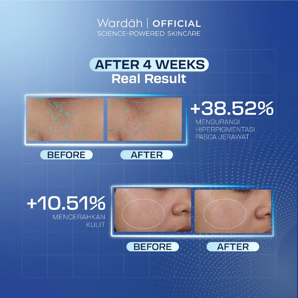Wardah Microneedle Serum Shot 30ml
