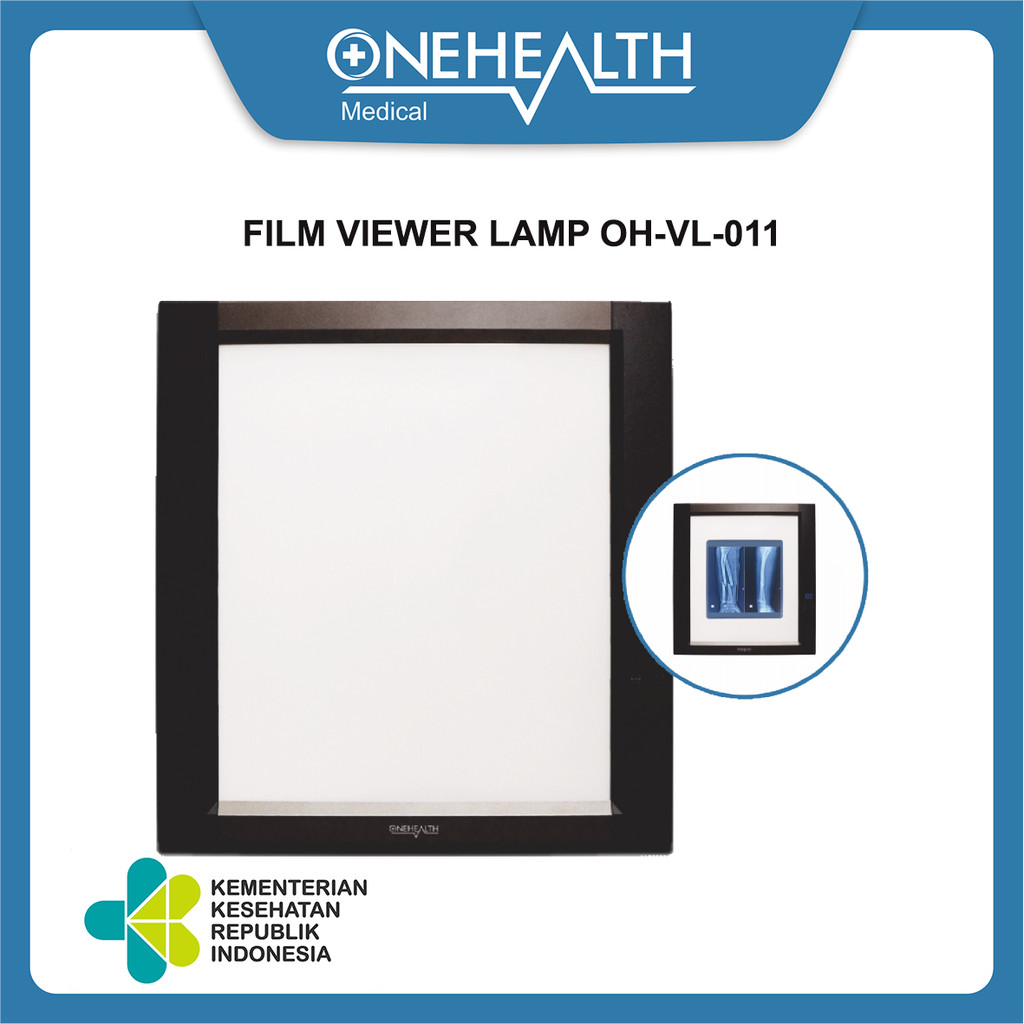 Jual Onehealth Film Viewer Lamp OH-VL011 Penampil Rontgen Radiologi ...
