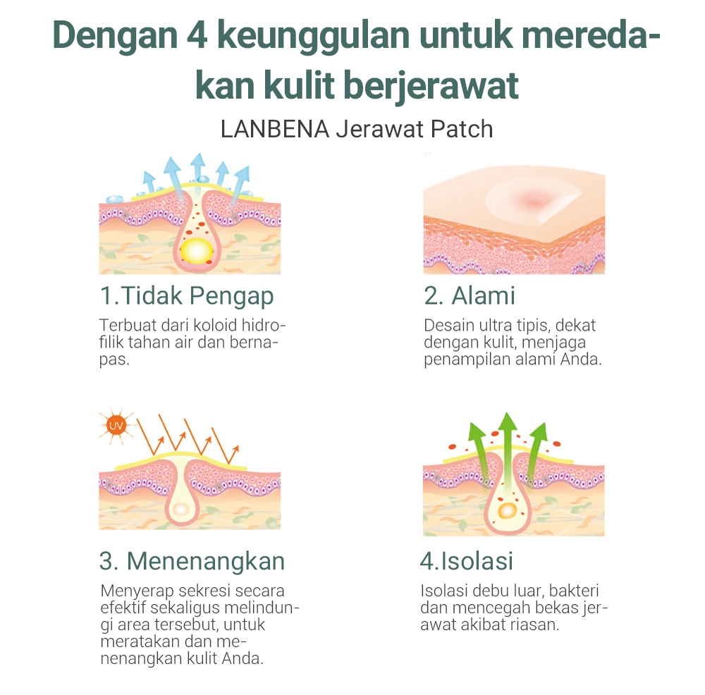 Jual [BPOM] Lanbena Acne Pimple Patch Obat Jerawat Masker Jerawat ...