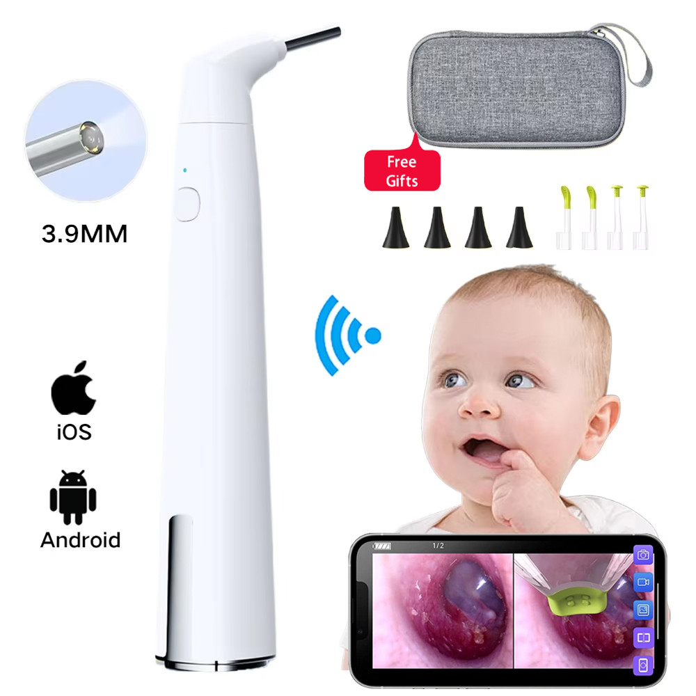 Jual New upgrade WIFI Digital Otoscope Ear Camera 3.9mm Ear Cleaning ...