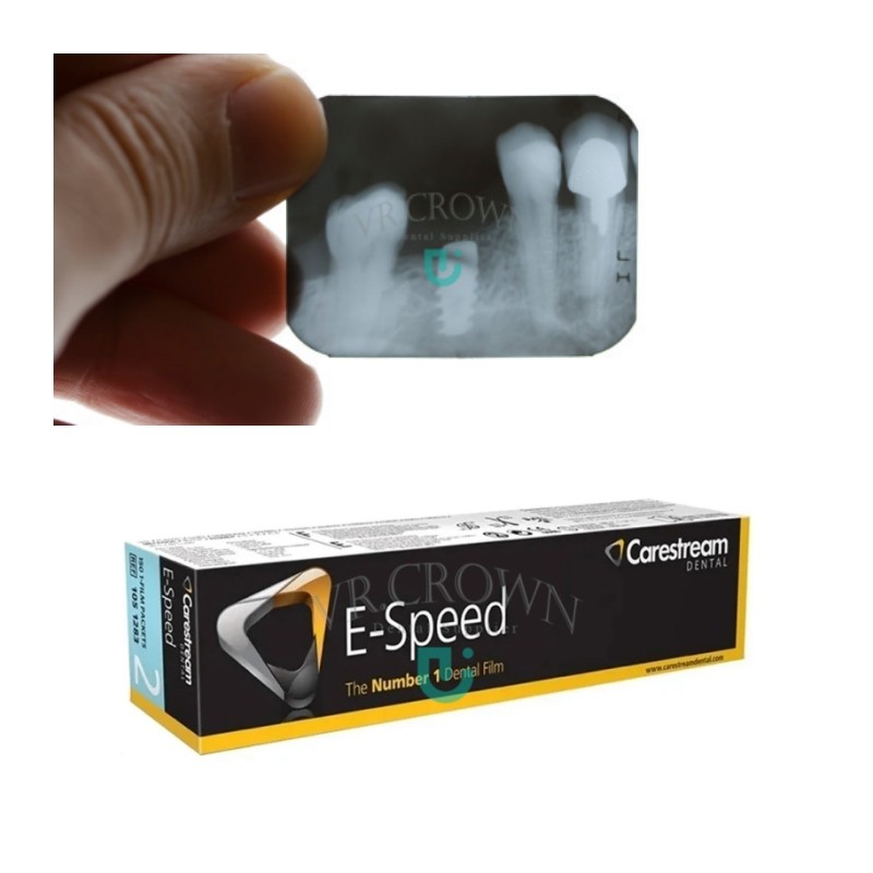 Jual CareStream D-Speed E-Speed Intraoral X-Ray Films Kodak Dental Use ...
