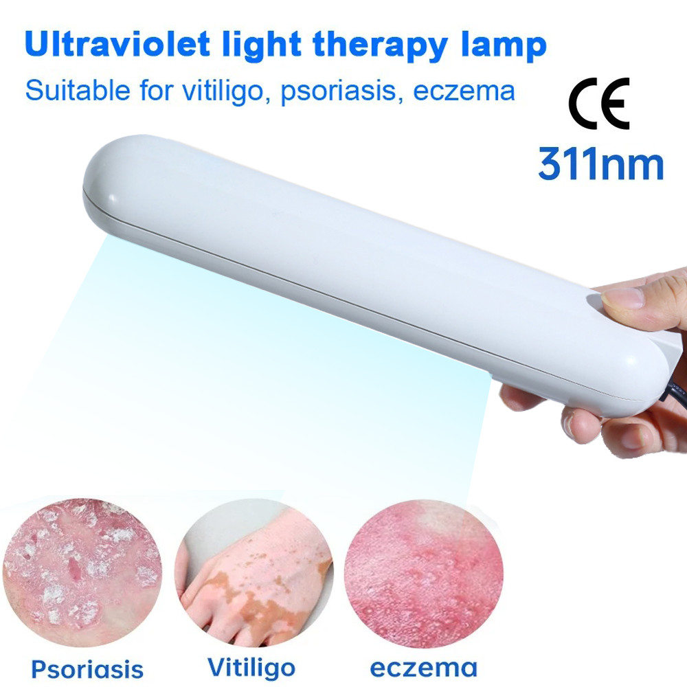 Jual 311Nm Portable Excimer Laser Uvb Phototherapy Machine Device Uv ...