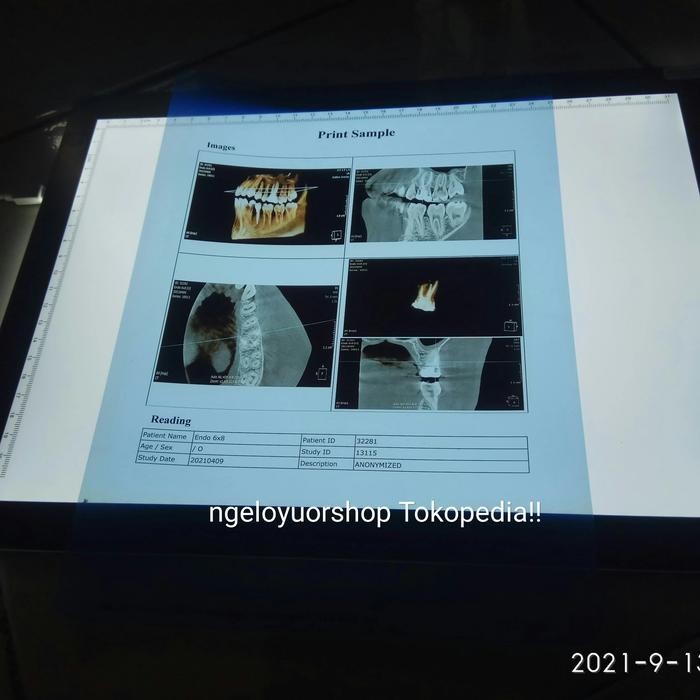 Jual gktu- Film Radiology Dr Cr Rontgen Ronsen Inkjet Blue Print ...