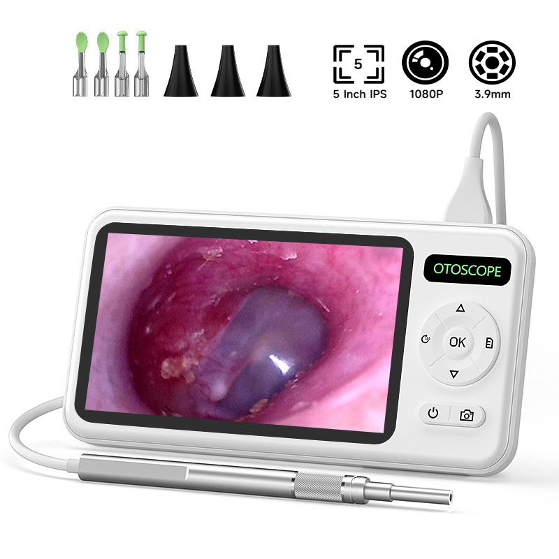 Jual Digital Ear Camera 5 Inch Ips Screen Hd1080P 3.9Mm Ear Picker 6 ...