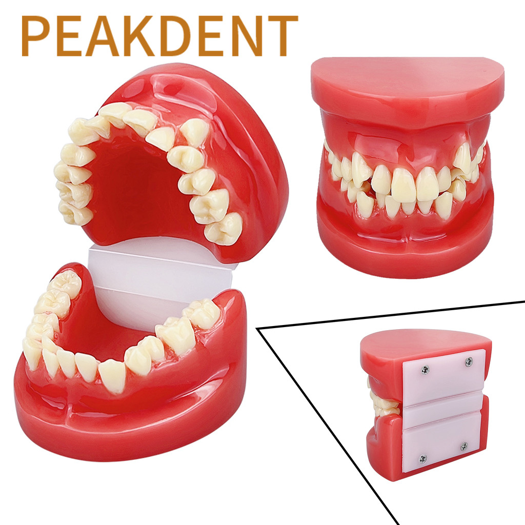 Jual TERBARU Dental Teeth Model Dental Teeth Malocclusion Model ...
