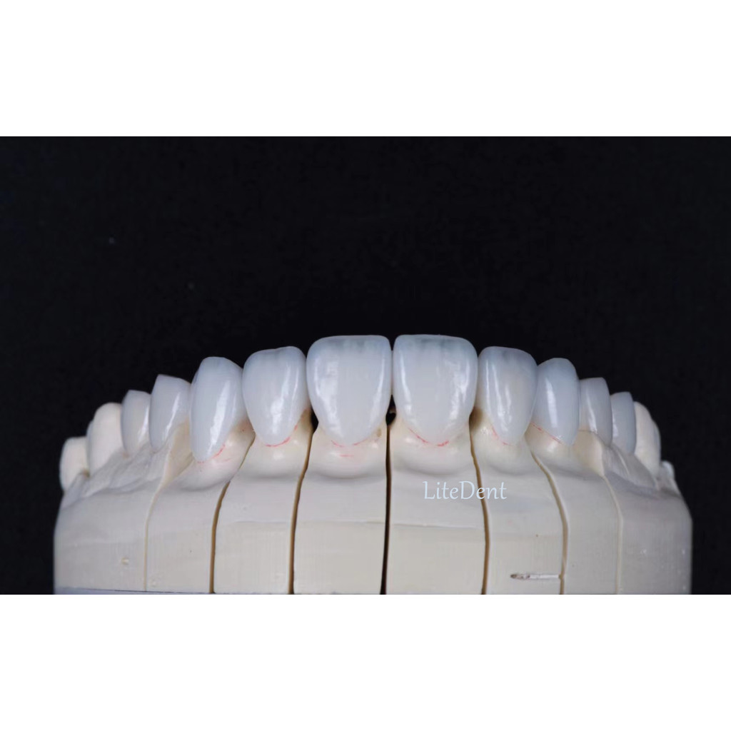 Jual JUAL ST White Zirkonzahn Zirconia Blocks Dental Zirconium Disc CAD ...