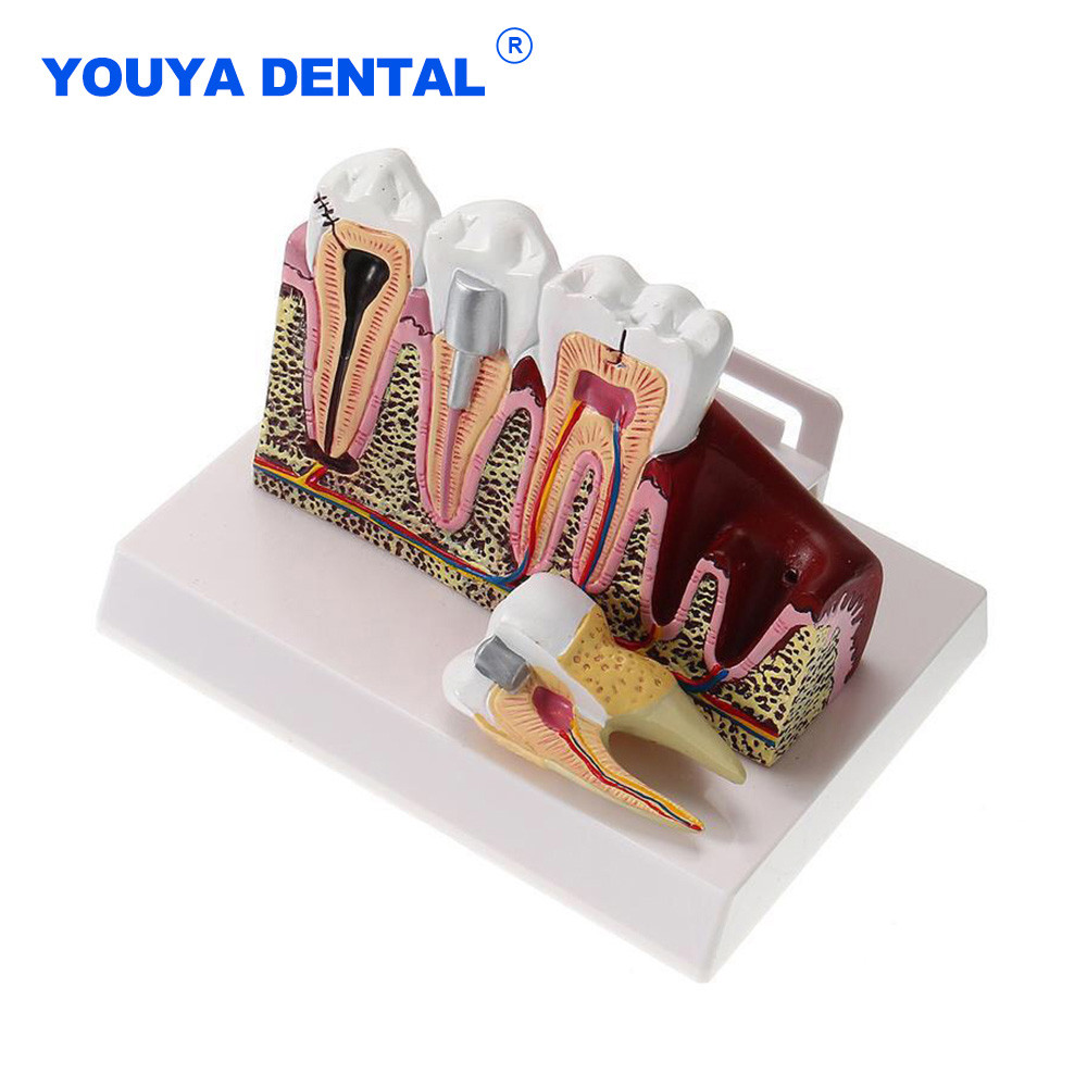 Jual Anatomical Structure Model Standard Dental Oral Teeth Teaching ...