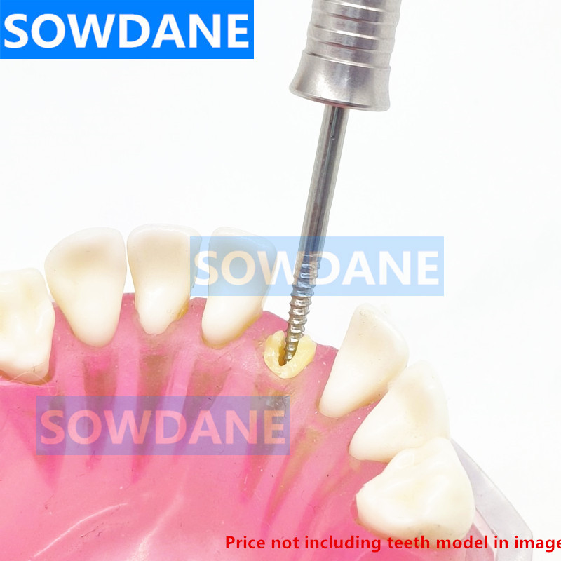 Jual Dental Root Tooth Extraction Screw Dental Root Screw Extractor ...