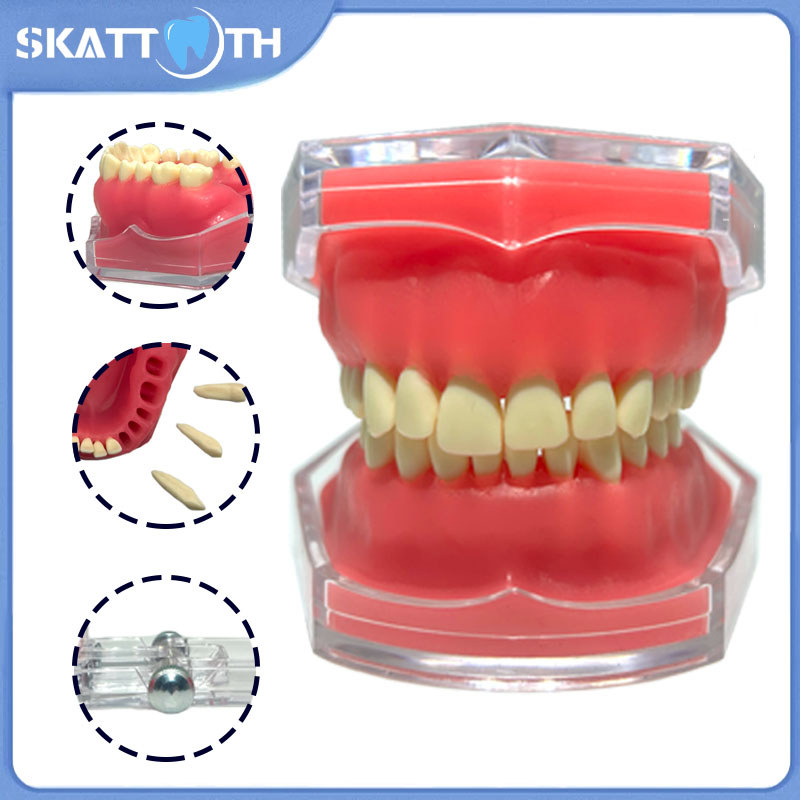 Jual NEW Dental Teeth Model With Removable Teeth Soft Gum Tooth ...