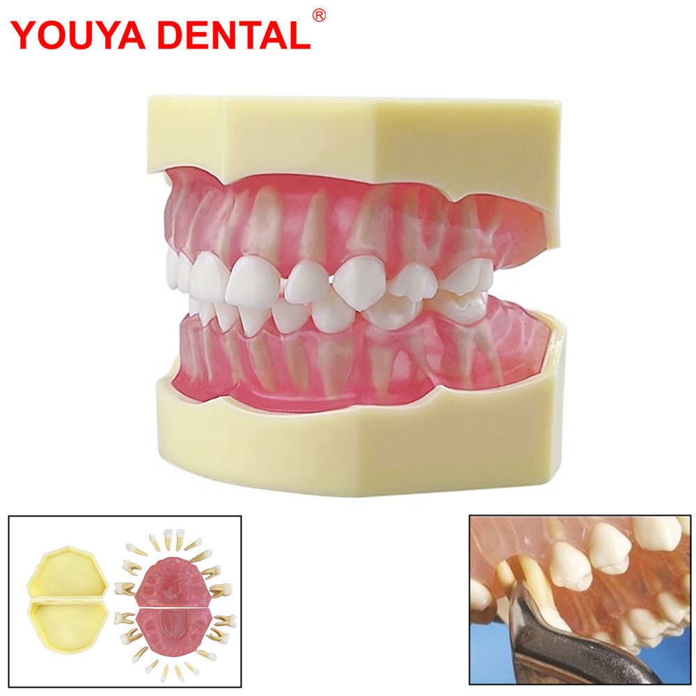 Jual PROMO Kids Teeth Model For Training Practice Tooth Extraction ...