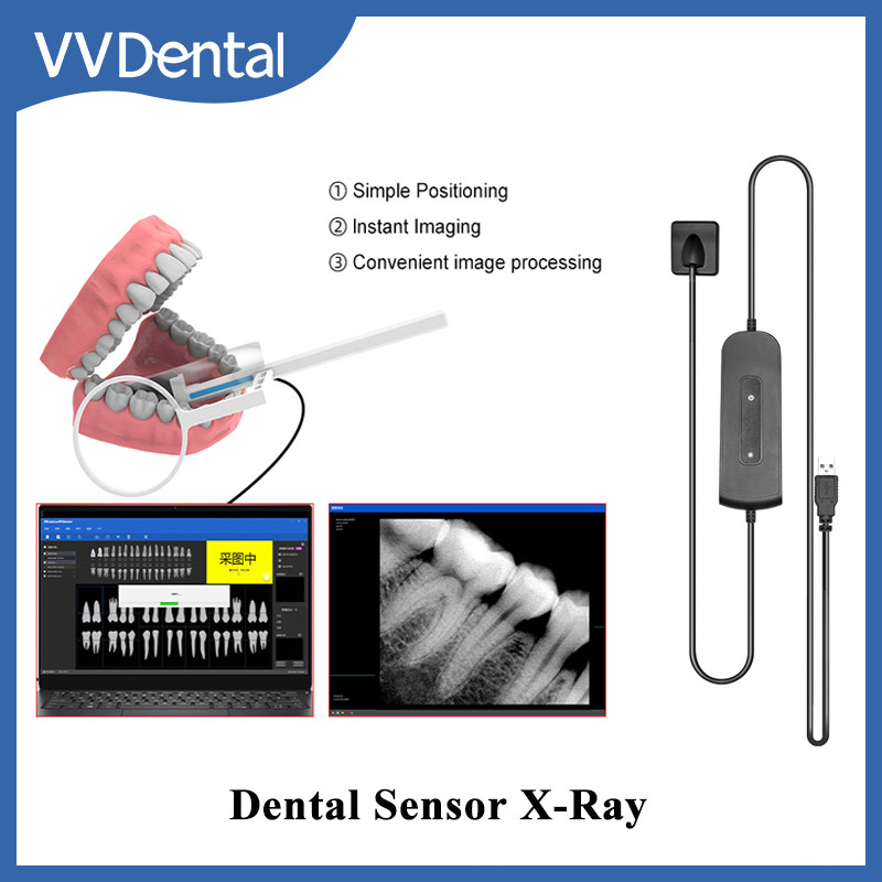 Jual Dental X-Ray Sensor Radiovisiograph RVG High Frequency Digital ...